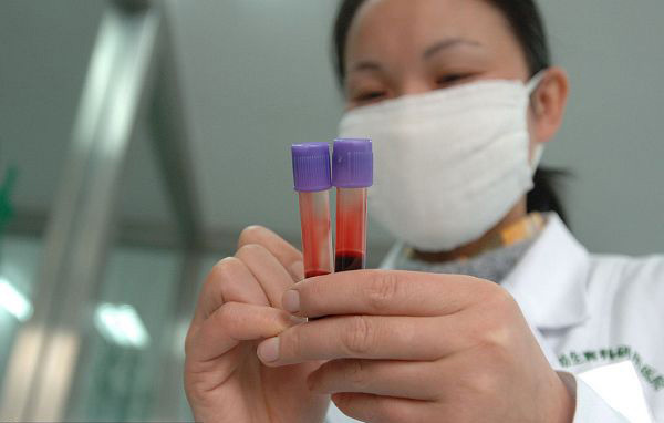 重庆揭秘：DNA亲子鉴定全过程 